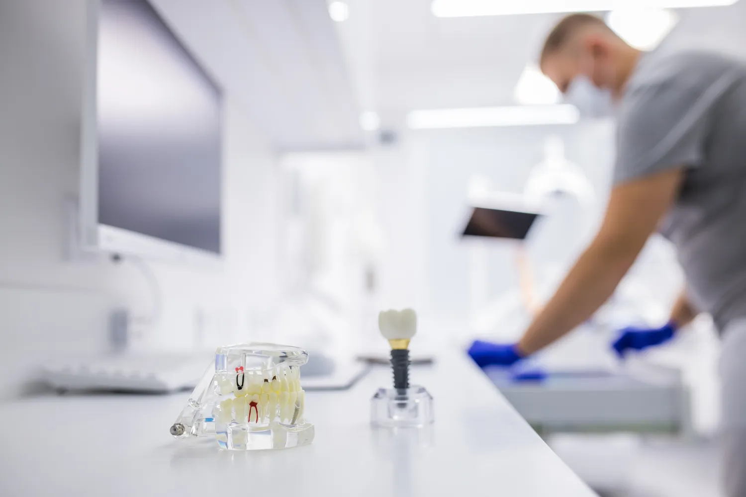 Ile czasu trwa leczenie kanałowe?