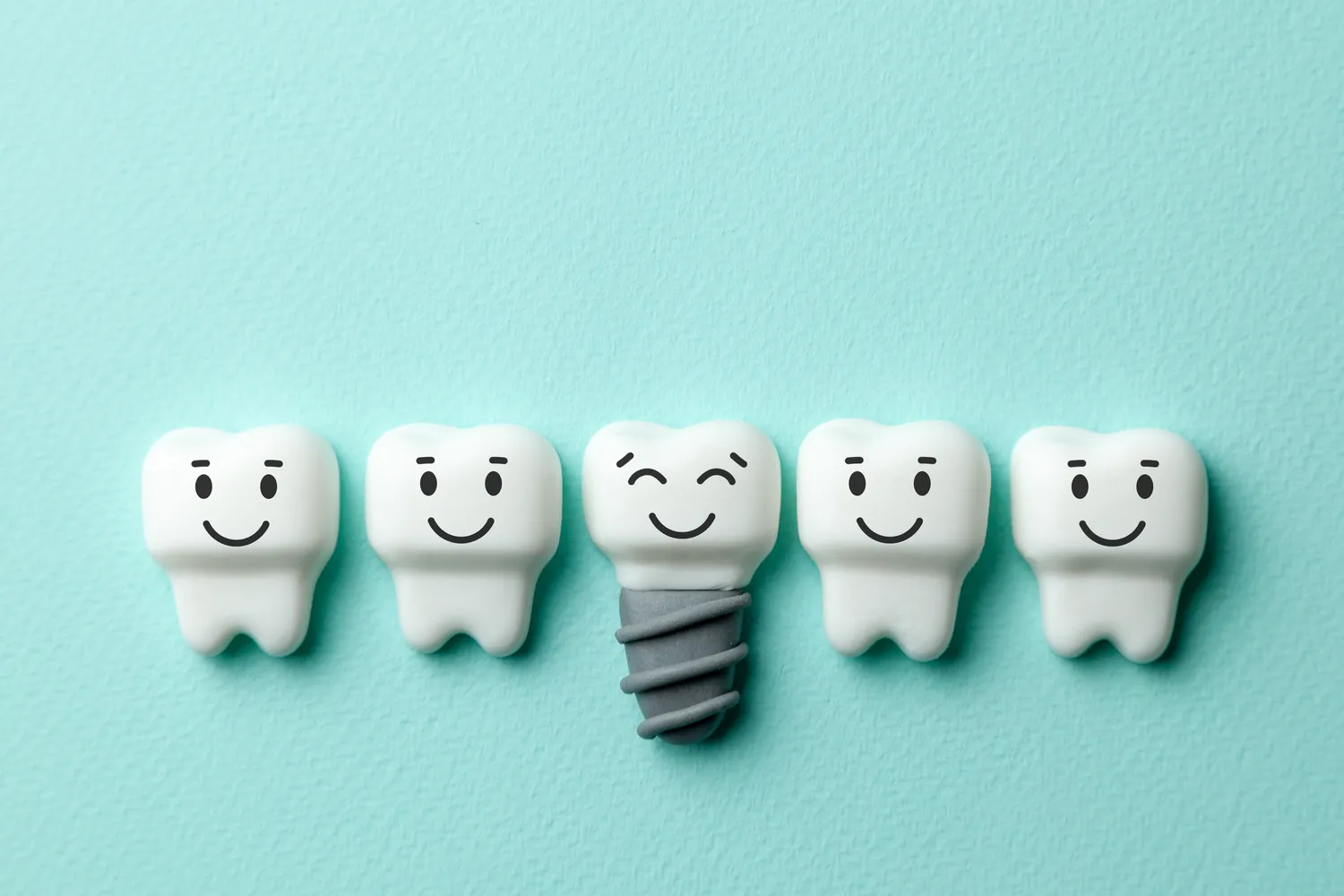 Leczenie kanałowe jak wygląda?