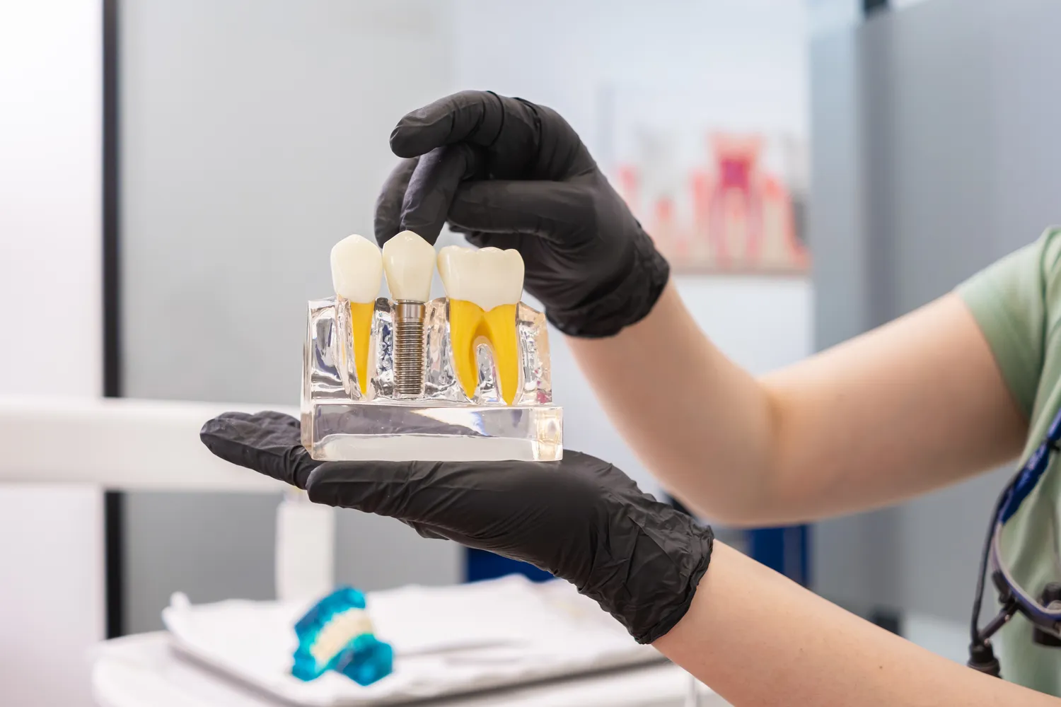 Implanty zębów co to jest?