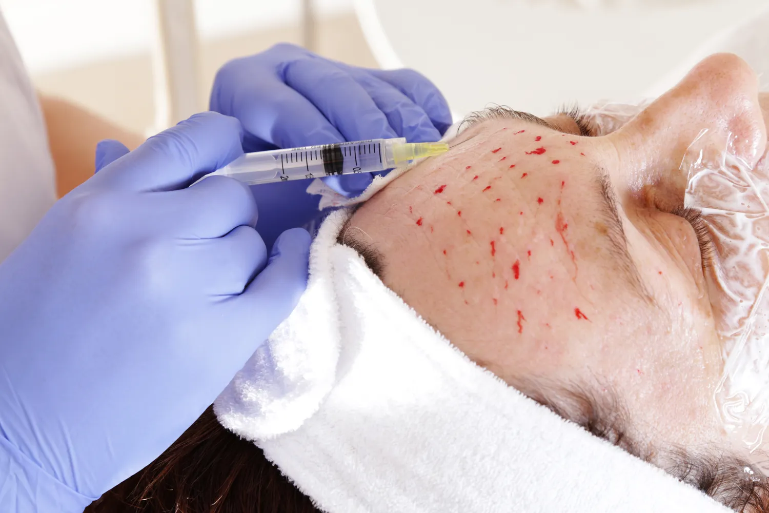 Medycyna estetyczna gdzie?