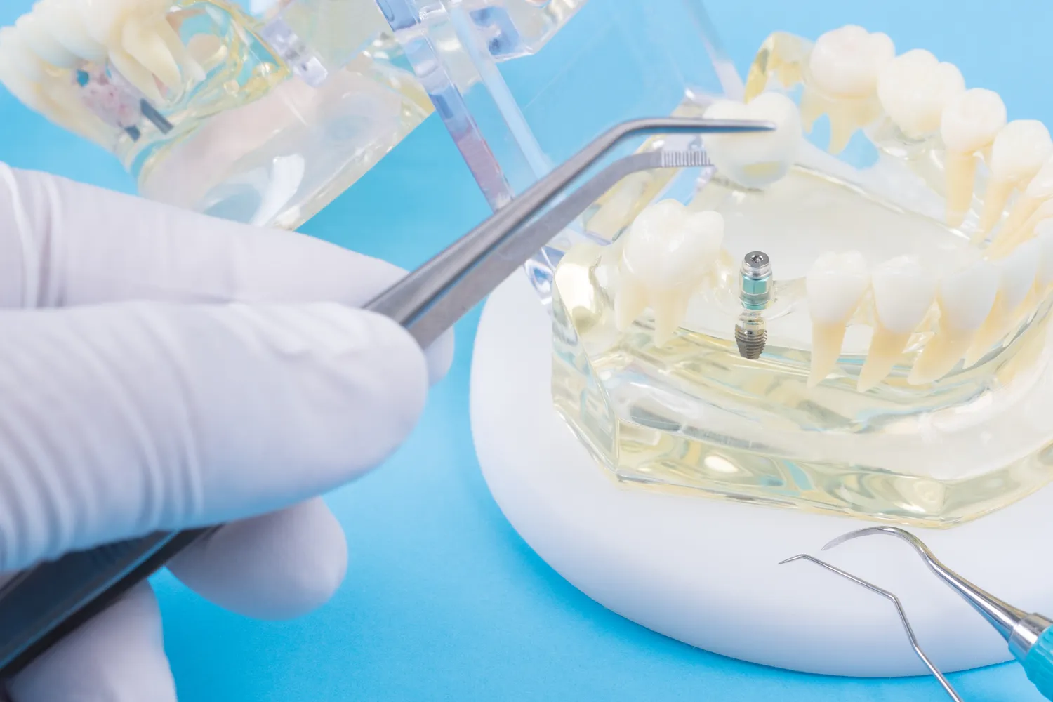 Umawianie się na wizytę do stomatologa